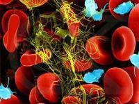 鐮狀細胞性腎病 鐮狀細胞性腎病