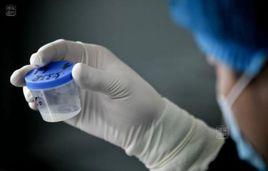 精液質量 精液質量