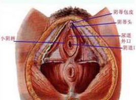 陰道粘連甚至閉鎖 陰道粘連甚至閉鎖