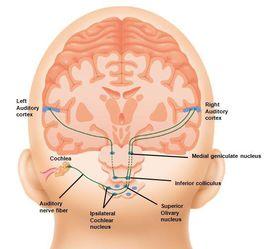 音高辨別 音高辨別