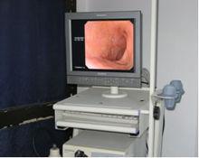 奧林巴斯V-70電子內鏡系統