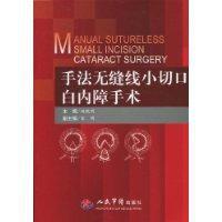手法無縫線小切口白內障手術 手法無縫線小切口白內障手術