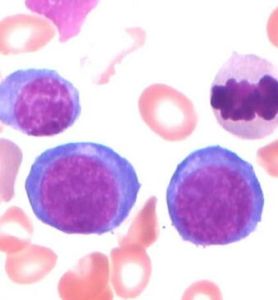 急性造血功能停滯 急性造血功能停滯