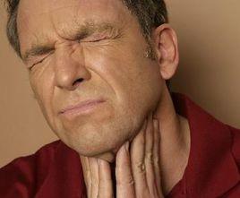 急性食管炎 急性食管炎