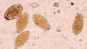 自體感染 自體感染