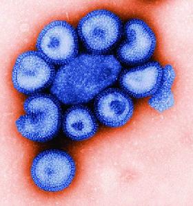 H1N1亞型豬流感病毒