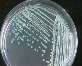 鏈孢囊菌屬 鏈孢囊菌屬