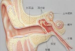 膽脂瘤型中耳炎