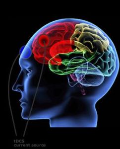 經顱直流電刺激 經顱直流電刺激