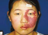 西安北方皮膚病醫院騙人的