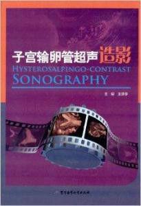 子宮輸卵管超聲造影 子宮輸卵管超聲造影
