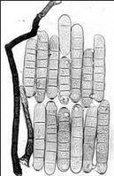 半知菌亞門 半知菌亞門