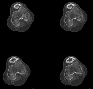 原發變態反應素