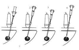 介入超聲 介入超聲