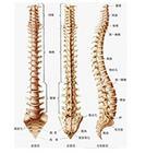 急性頸椎間盤突出症