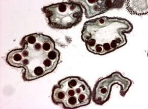 湖泊鞘絲藻 湖泊鞘絲藻