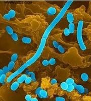 自生固氮菌 自生固氮菌