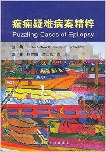 癲癇疑難病案精萃 癲癇疑難病案精萃