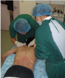 經絡介入激活療法