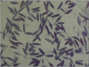 小孢子體 小孢子體