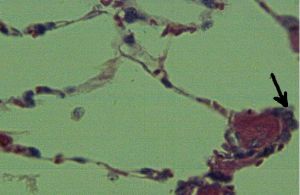 二型肺泡上皮細胞 二型肺泡上皮細胞