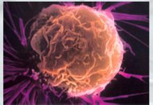 癌細胞繁殖