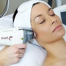 飛梭鐳射 飛梭鐳射