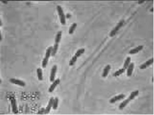 木醋桿菌 木醋桿菌