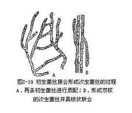 布勒現象 布勒現象