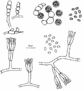 糙刺籃狀菌 糙刺籃狀菌