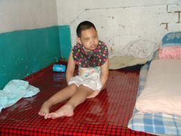 小兒輕度腦癱 小兒輕度腦癱