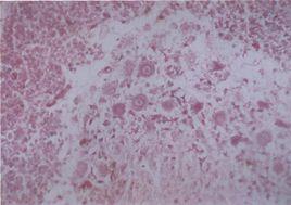 尼氏小體 尼氏小體