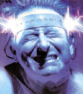 電擊療法 電擊療法