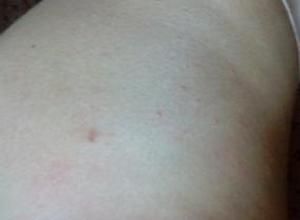 孕婦肚子癢 孕婦肚子癢