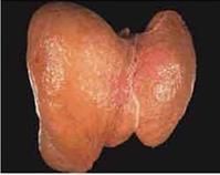 鴨大肝病 鴨大肝病