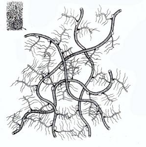 盆腔結締組織炎