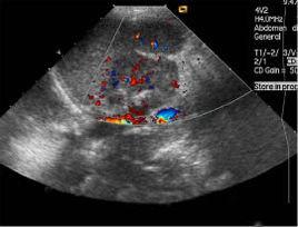 都卜勒彩超 都卜勒彩超