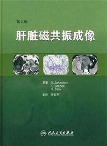 肝臟磁共振成像