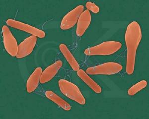（圖）艱難梭狀芽孢桿菌小腸結腸炎
