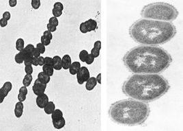 溶血性鏈球菌 溶血性鏈球菌