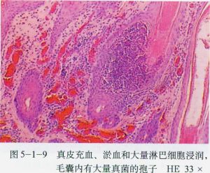 皮膚病變顯微結構