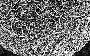 （圖）避孕疫苗