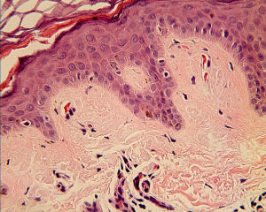 色素異常 色素異常