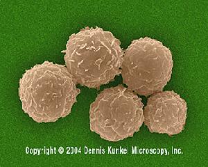 骨髓幹細胞膠水 骨髓幹細胞膠水