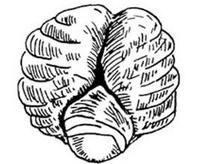 完全性陰莖陰囊轉位示意圖