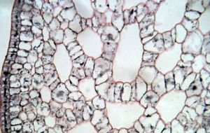 骨狀石細胞 骨狀石細胞