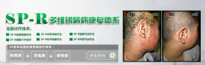 sp-r多維銀屑病治療體系