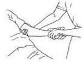 兩臂不能上舉而成垂肩 兩臂不能上舉而成垂肩