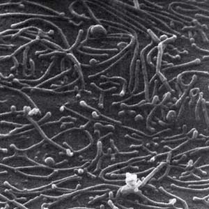 花粉過敏性哮喘