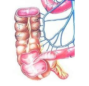 闌尾炎[草藥的快速根治]